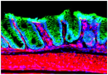 Fig 1: Exist of mesenchymal layer (red) underneath of epithelium (green)