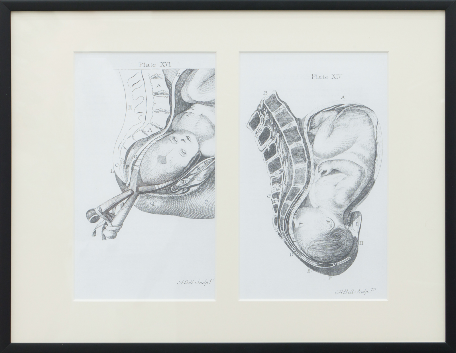 A sett of anatomical tables, with explanations, and an abridgment, of the practice of midwifery by William Smellie