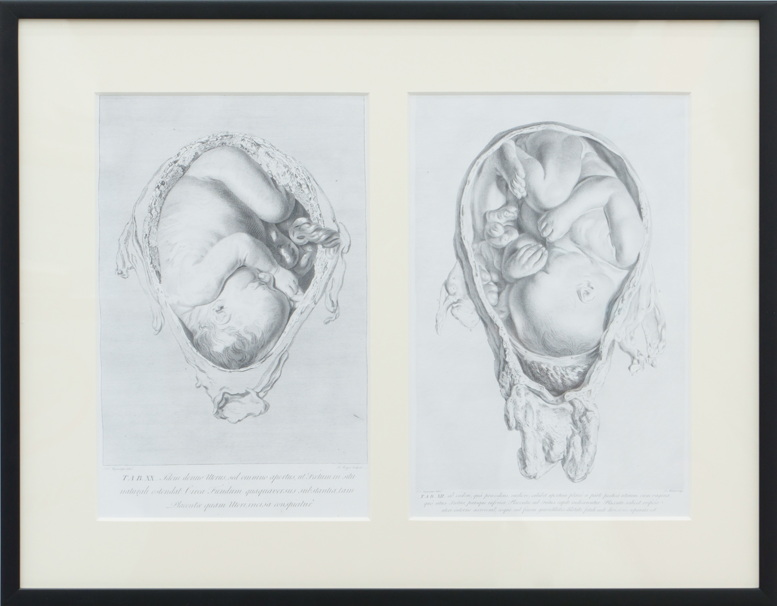 Anatomia uteri humani gravidi tabulis illustrata by William Hunter