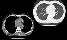 CT・MRI